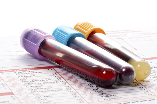 Blood tests for hair loss